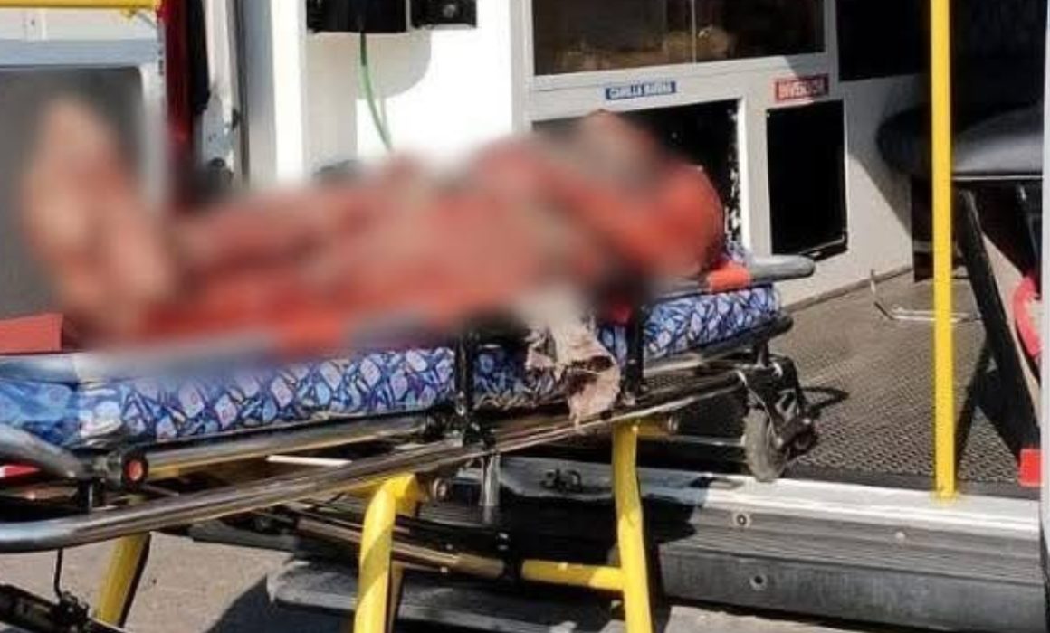 Ataca manada de perros a indigentes en calles de Ixtapaluca