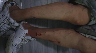 Aumentan ataques de perros en Edomex: ya son seis incidentes en octubre