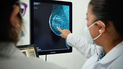 Desafíos y avances en la lucha contra el cáncer de mama en el Estado de México