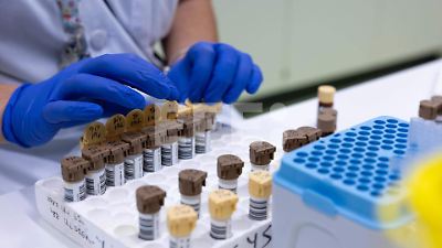 El intestino, un sexto sentido que regula el hambre en tiempo real