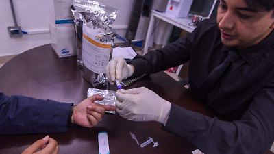 Incremento en casos de VIH en el Estado de México durante 2025 alarma a las autoridades sanitarias