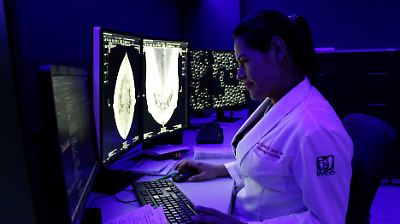 Innovador avance del IPN: posible tratamiento que podría frenar la metástasis del cáncer de mama