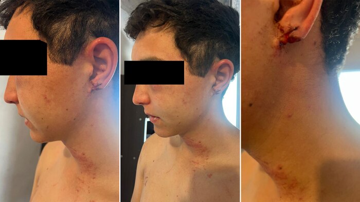 Joven de 20 años brutalmente torturado y amenazado en una estancia de Vedia: un intento de asesinato encubierto