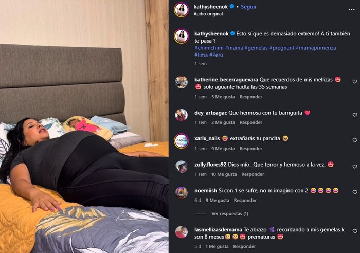 Kathy Sheen enfrenta con esperanza el síndrome de transfusión feto-fetal que pone en riesgo la vida de sus gemelas