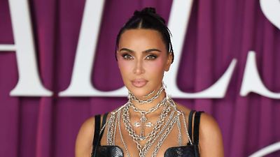 Kim Kardashian revela que tiene un aneurisma cerebral: ¿qué es y qué riesgos implica?