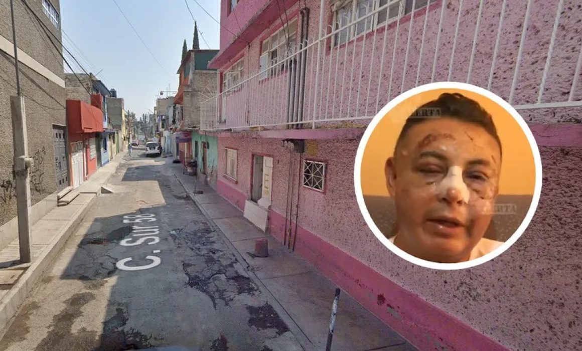 Liberan al agresor de brutal ataque con machete en Ecatepec pese a gravedad de las lesiones