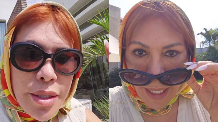 Magaly Medina muestra su rostro sin moretones y espera seis meses para resultados completos