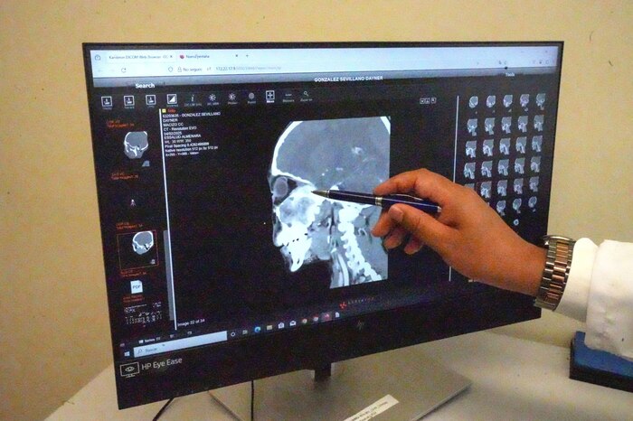 Pacientes con aneurismas en riesgo mortal: ¿Hasta cuándo esperan? La historia de una mujer que pide justicia en EsSalud