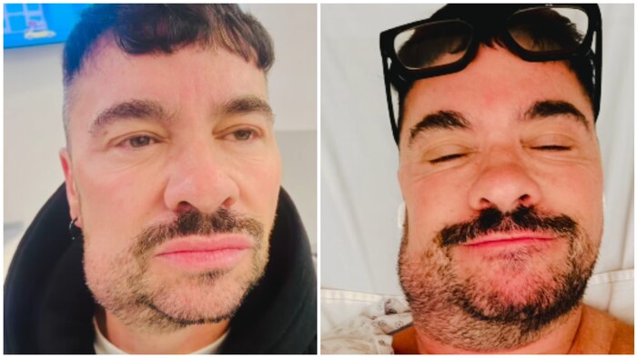 Shiky hospitaliza por segunda vez tras cirugía de muela y revela complicación insólita