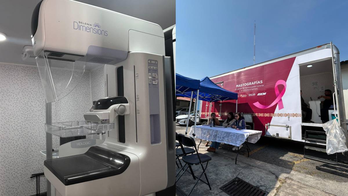 ¡Sorprendente! Cómo las unidades móviles de mastografías en Edomex están salvando vidas femeninas